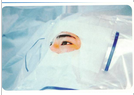 一次性眼科手术包